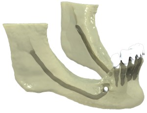 Mandibular Arch